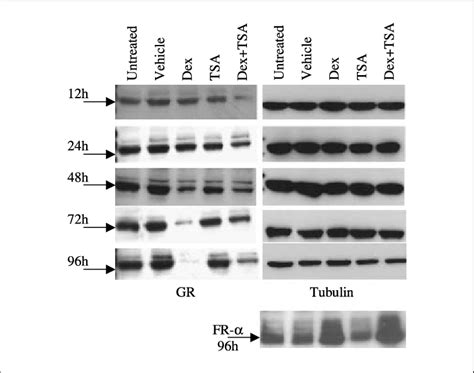 Effect Of Dexamethasone And Trichostatin A On Gr Expression Hela Cells