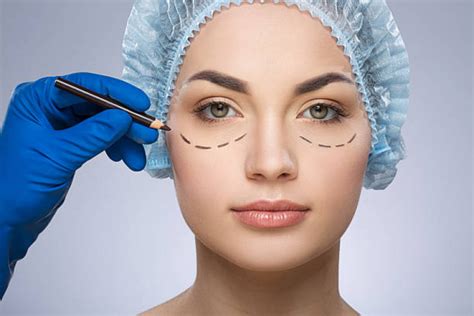 Blefaroplastia A Laser CLINICA OFTALMOLOGICA DR TADAAKI YAMADA