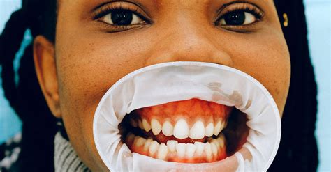 Female Ethnic Patient With Open Mouth In Dental Clinic · Free Stock Photo