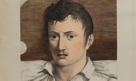 The Yellow Fever Epidemic Begins in Fever 1793 | Shortform Books