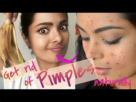 How To Get Rid Of Pimples