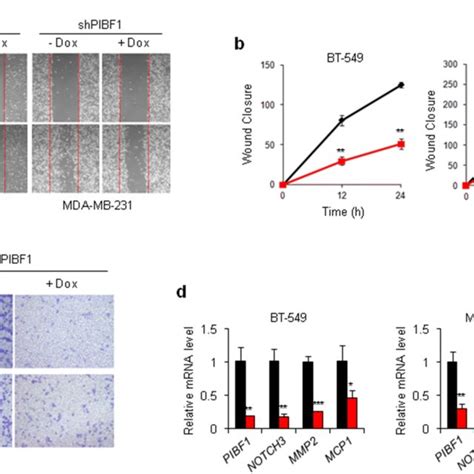 PIBF1 Knockdown Inhibits The Migration Of TNBC Cell Lines A C TNBC