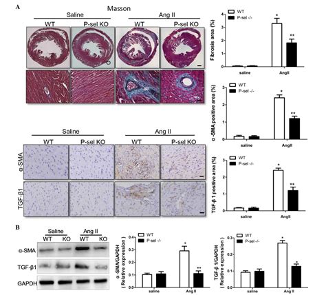 P‑selectin Increases Angiotensin Ii‑induced Cardiac Inflammation And