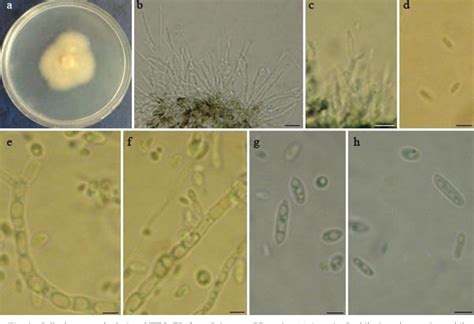 Figure From New Reports Of Endophytic Fungi Associated With Cherry