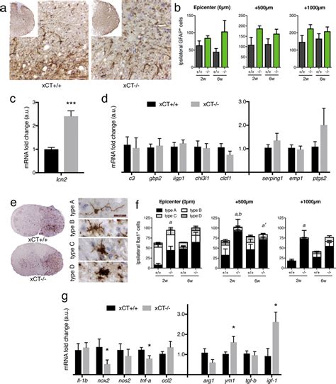 Assessment Of Astrocyte And Microglia Activation In Injured Xct And