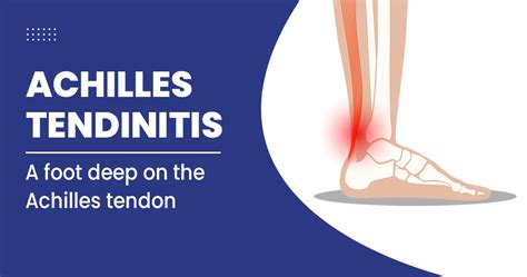 Achilles Tendinitis Types Symptoms Causes Diagnosis Off