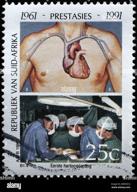 First heart transplant operation celebrated on south african stamp Stock Photo - Alamy