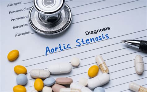 15 Aortic Stenosis Symptoms You Need to Know