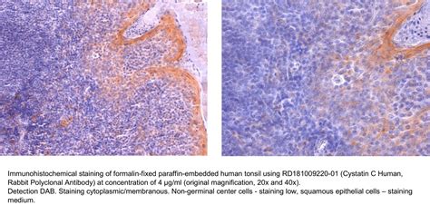 Cystatin C Human, Rabbit Polyclonal Antibody | BioVendor R&D