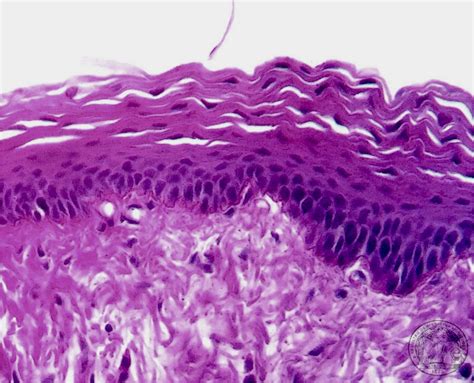 Mucosa Lingual Histología Y Embriología