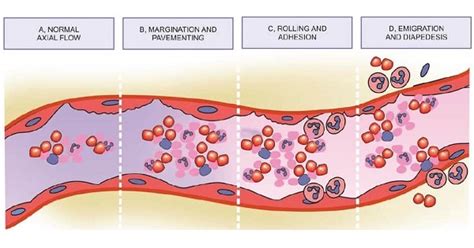 Acute Inflammation Cellular Events