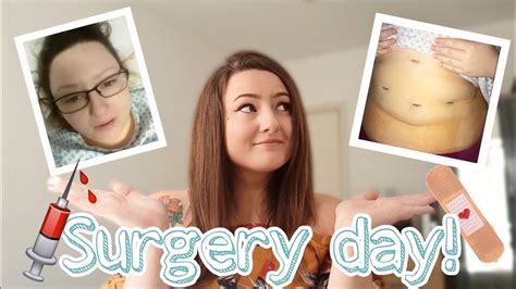 Vsg Surgery Day Youtube