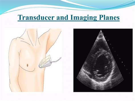 Echocardiographic Assessment Of Left Ventricular Systolic Function Ppt