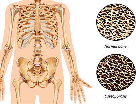 Chapter 1: The Skeletal System