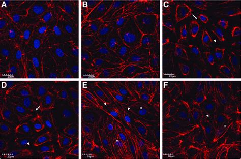 The effect of p38 MAP kinase inhibition by SB203580 on IFN-g-induced ... 
