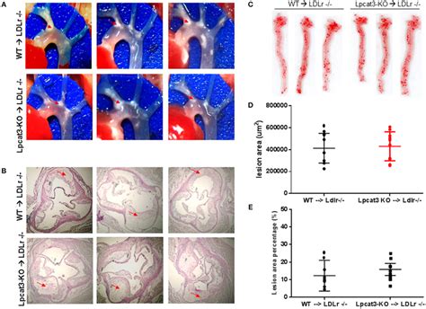 Atherosclerosis Measurement In Female Wt Ldlr Ko And Lpcat Ko Ldlr