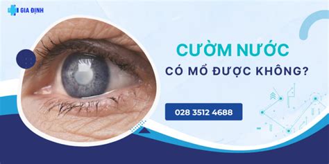 B Nh C M N C Glaucoma C M C Kh Ng