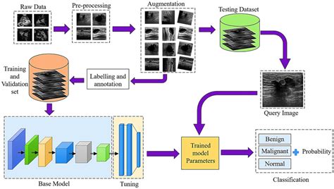 Block Diagram Of Proposed Deep Learning Based Automatic Breast Tumor