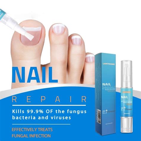 Powerful Nail Treatment Pen Onychomycosis Paronychia Anti Fungal Nail