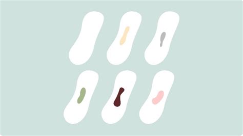 Vaginal Discharge Color Guide Reproductive Health