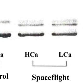 Electrophoretic Separation Of Myosin Heavy Chain MHC Isoforms In