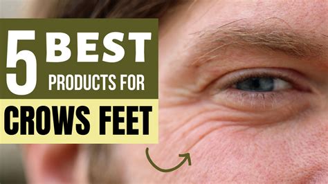 5 Best Products For Crow's Feet: What Are Crow's Feet? - Holistic Health HQ