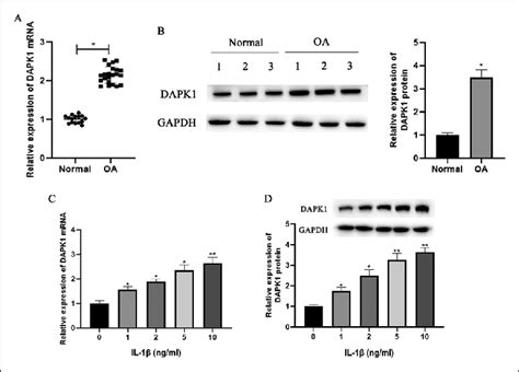 Dapk1 Was Overexpressed In Oa Cartilage And Il 1β Stimulated