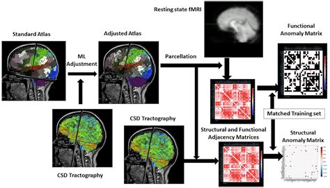 Frontiers Application Of Structural And Functional Connectome