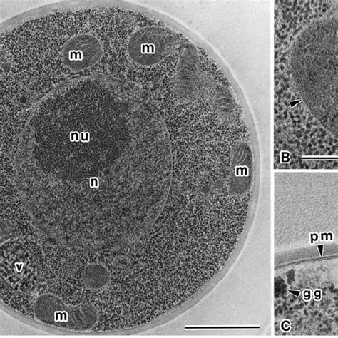 Ultrathin Sections Of Freeze Substituted C Neoformans Cell