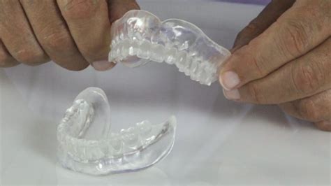 All In One Implant Trays Good Fit ® Expedited Denture Systems Youtube