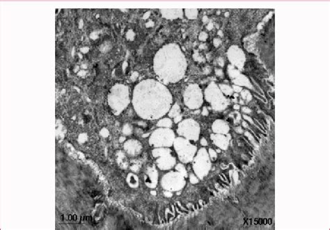 B: A higher magnification (X15000) electron microscope photomicrograph ...