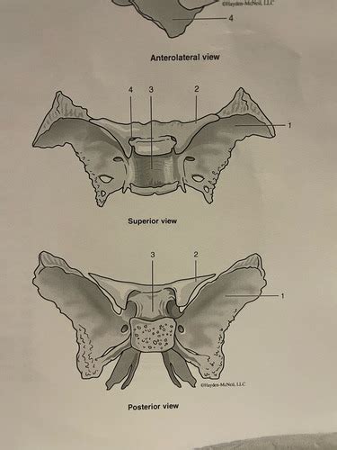 Ethmoid And Sphenoid Bone Flashcards Quizlet