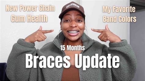 15 Month Braces Update Gum Health New Power Chain Band Colors Adult Braces Merry