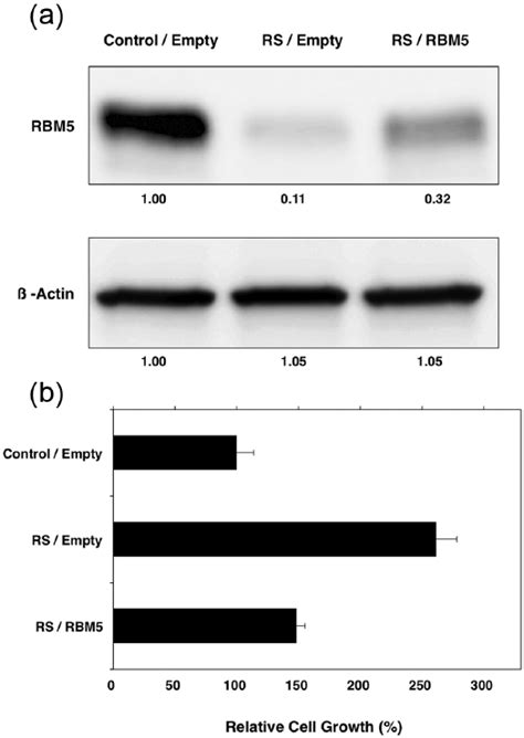 RBM5 Restoration Abrogates The Augmentation Of Cell Proliferation By