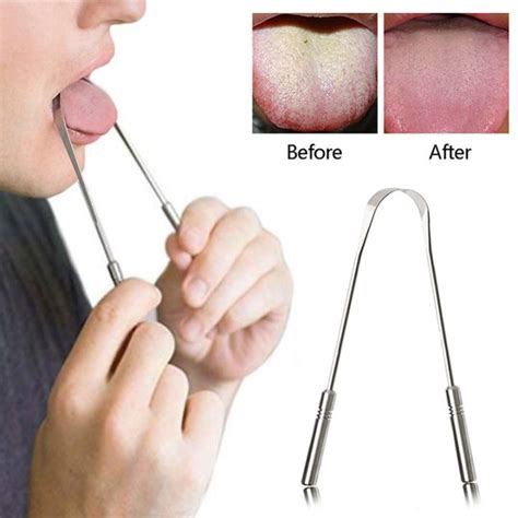 Stainless Steel U Shaped Tongue Scraper Tongue Cleaner Oral Hygiene