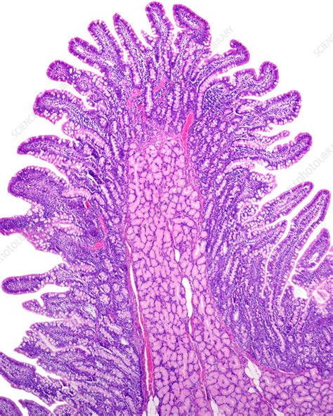 Brunner glands in duodenum, light micrograph - Stock Image - C059/3793 - Science Photo Library