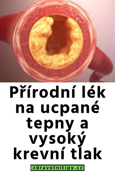 Přírodní lék na ucpané tepny a vysoký krevní tlak With images