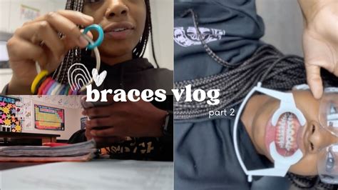 Vlog Come Get Braces With Me Pt 2 School Costco Run Bottom Braces