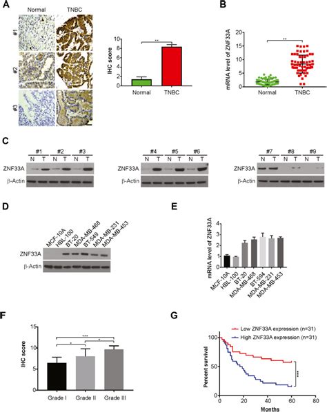 ZNF33A Promotes Tumor Progression And BET Inhibitor Resistance In