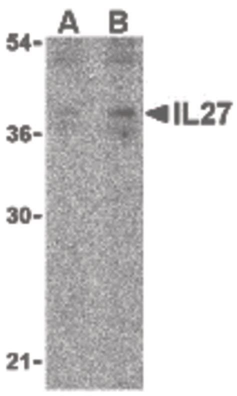 Ihc Plus Il Polyclonal Antibody Rabbit Anti Human Lsbio