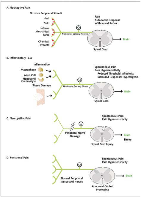 Figure 1 From Mupirocin Prophylaxis Against Nosocomial Staphylococcus Aureus Infections In