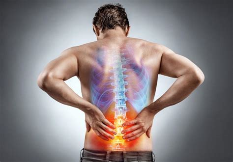 Understanding Your Back Pain Spinal Stenosis With Neurogenic