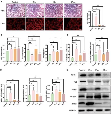 Ferroptosis Is Activated By Ischemiareperfusion At An Early Stage In