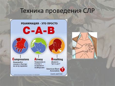 Сердечно-легочная реанимация (СЛР). Показания, принципы, техника ...