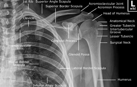 Radiografia Ap De Hombro