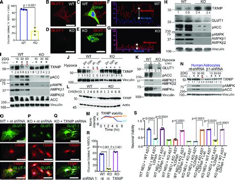 Ampk Preserves Glut1 And Its Surface Translocation By Destabilizing