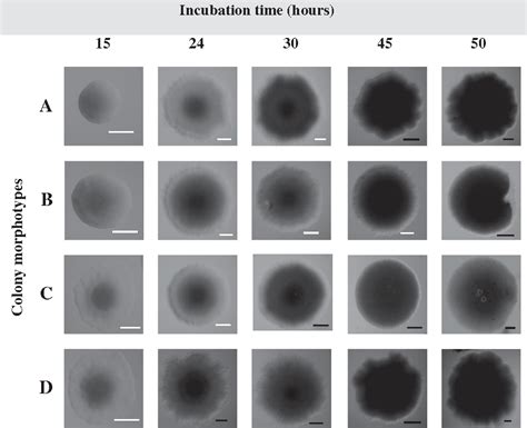 Bacterial Colony Morphology Chart: A Visual Reference of Charts | Chart ...