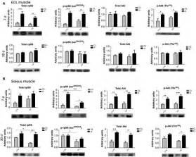 Western Blots Of EDL And Soleus Muscles After 7 And 30 Days Of