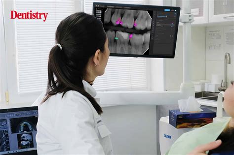 AI And Dental Case Acceptance A Beneficial Relationship Dentistry