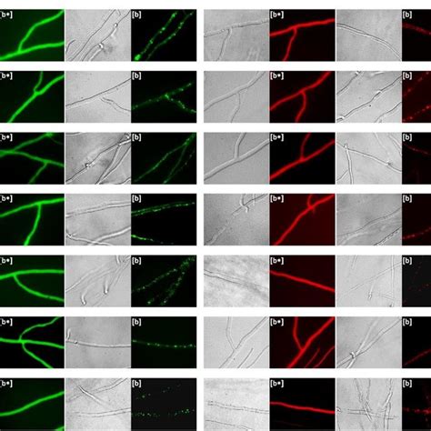 Bass Motif Prion A Formation In Podospora Anserina Micrographs Of P Download Scientific